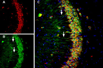 Multiplex staining of Calnexin and Presenilin-1 in mouse hippocampus