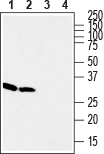 Western blot analysis of rat (lanes 1 and 3) and mouse (lanes 2 and 4) brain lysates :
