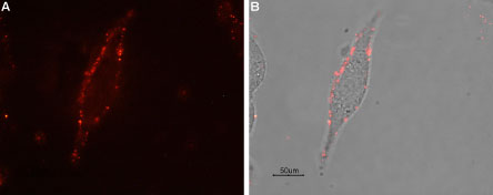Expression of µ-opioid receptor (MOR-1) in rat C6 cells