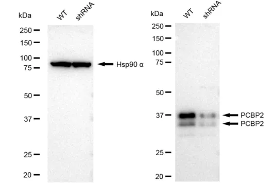 KVAb01763
