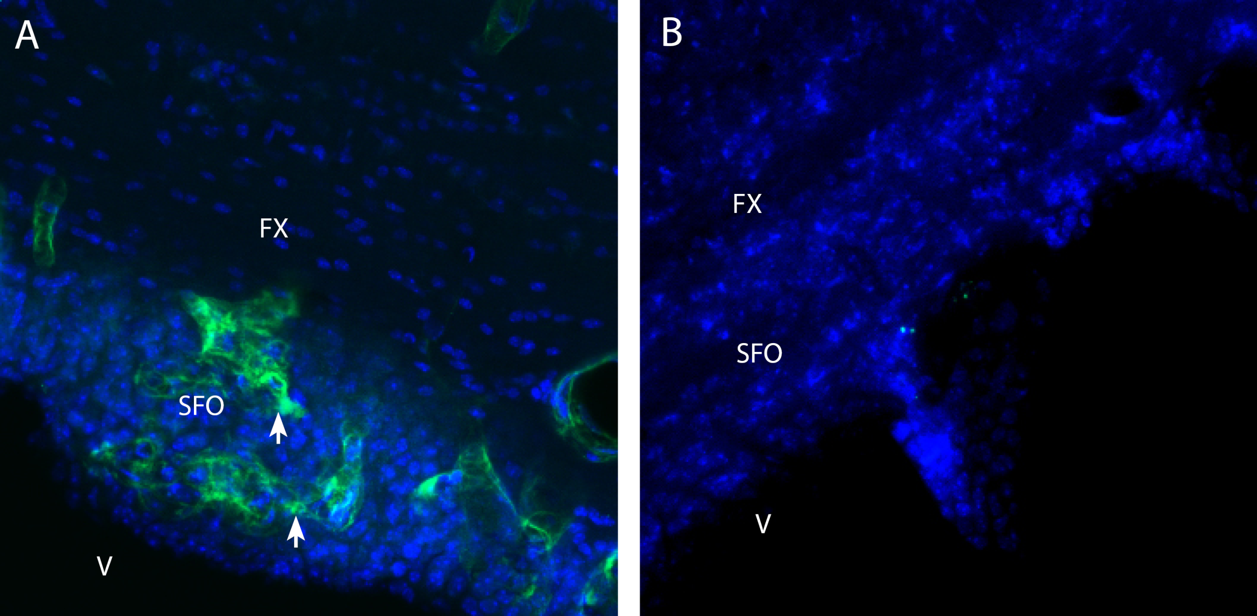 M3 muscarinic receptor (M3MR) in mouse sub-fornical organ (SFO)