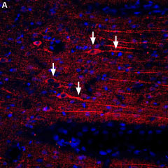 Expression of CXCR4 in rat brain