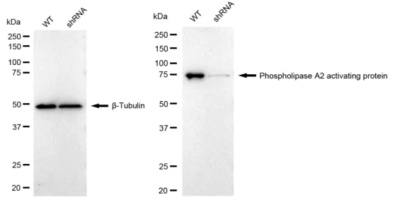 KVAb01494
