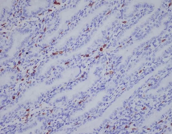 AMRe84510