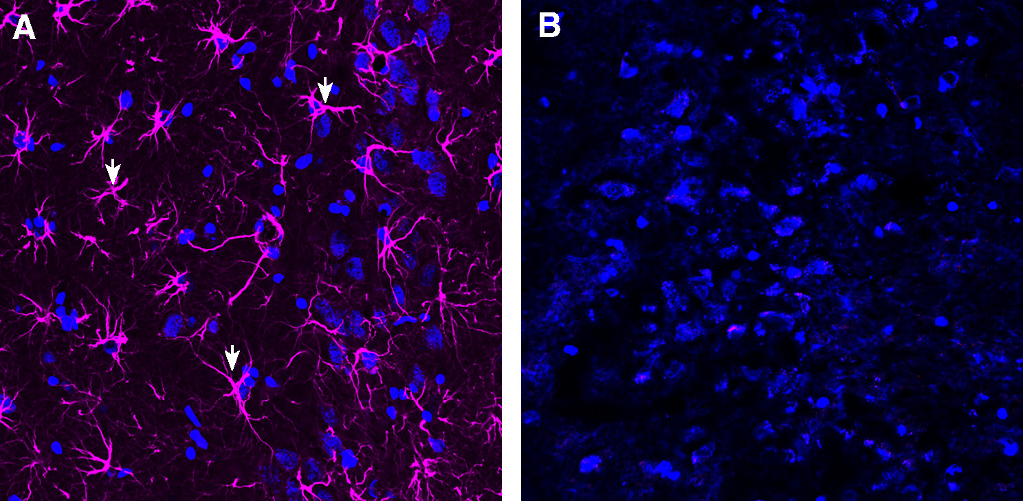 Expression of GFAP in rat hippocampus.