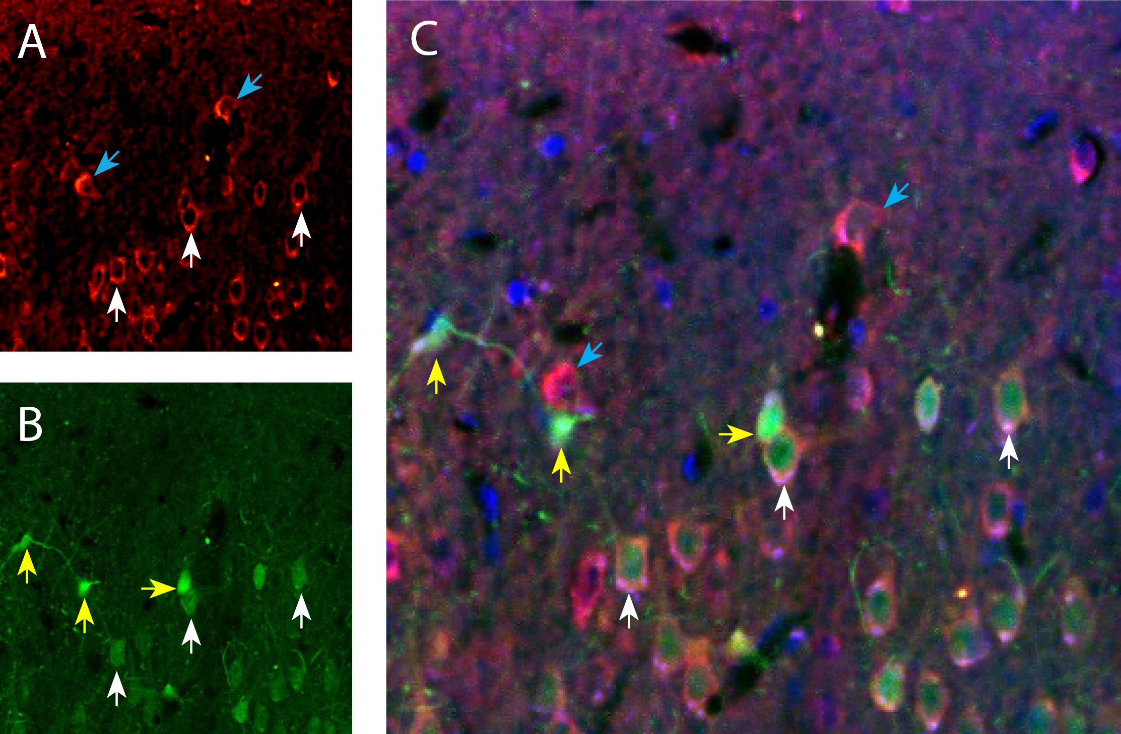 Piezo1 and calbindin D28k in rat parietal cortex