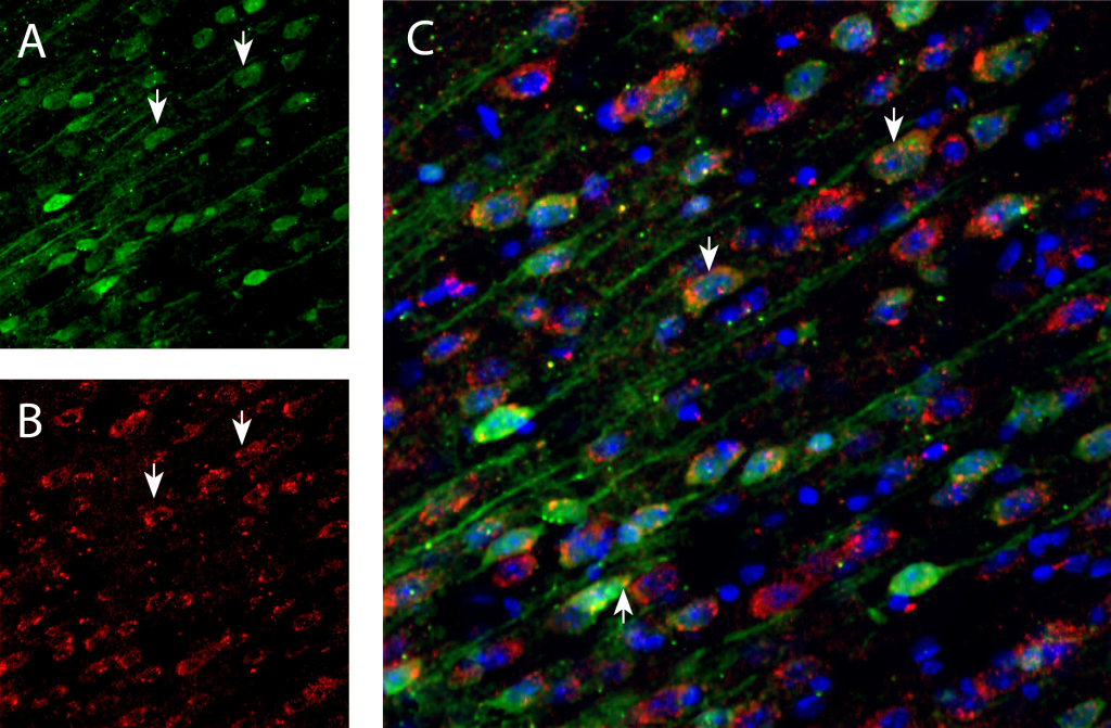 Multiplex staining of DARPP32 and D1 Dopamine Receptor in mouse cortex