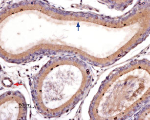 Expression of PAR-4 in rat epididymis
