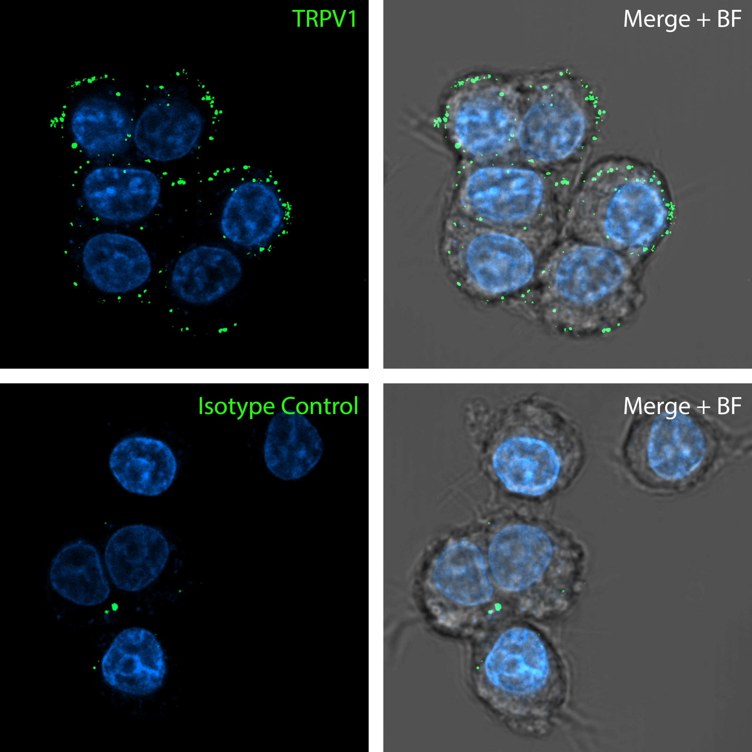 Detection of TRPV1 in rat PC12 cells