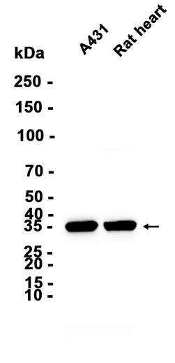 AMRe86963