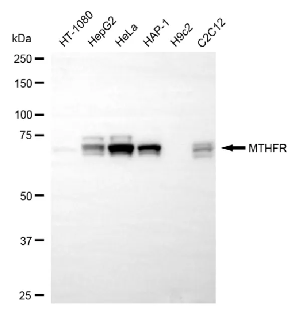 KVAb00392
