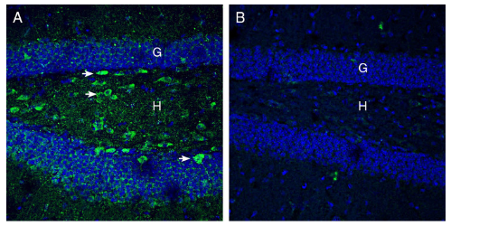 Expression of Netrin-1 in mouse hippocampus.