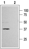Western blot analysis of rat pancreas membranes: