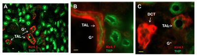 Expression of K ir 4.1 in mouse kidney sections.
