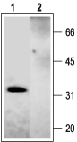 Western blot analysis of rat brain membranes: