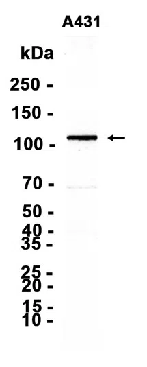 AMRe86627