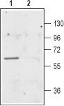 Western blot analysis of rat brain membranes: