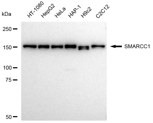 KVAb01297