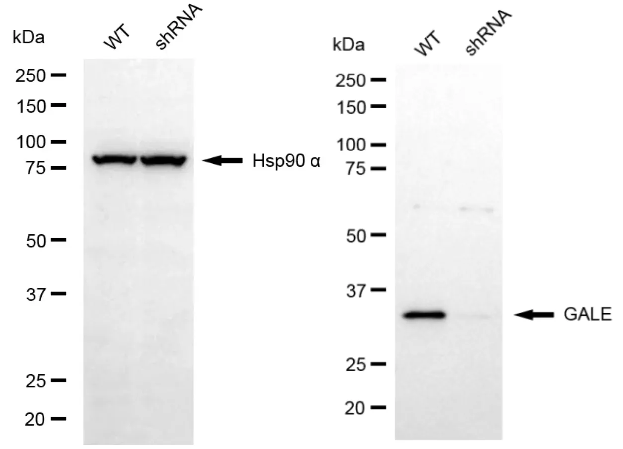 KVAb00539