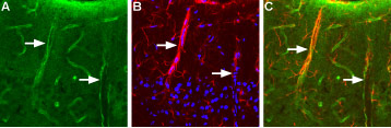 Expression of Aquaporin 4 in rat brain