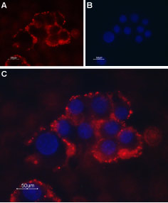 Expression of TRPC1 in PC12 cells