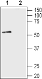 Western blot analysis of mouse brain lysate: