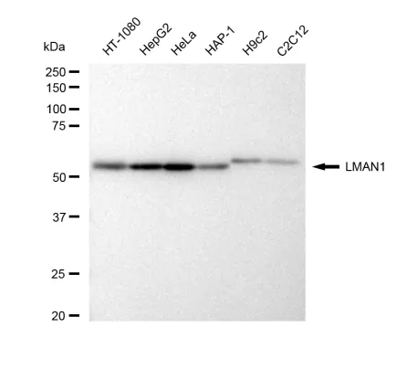 KVAb01172