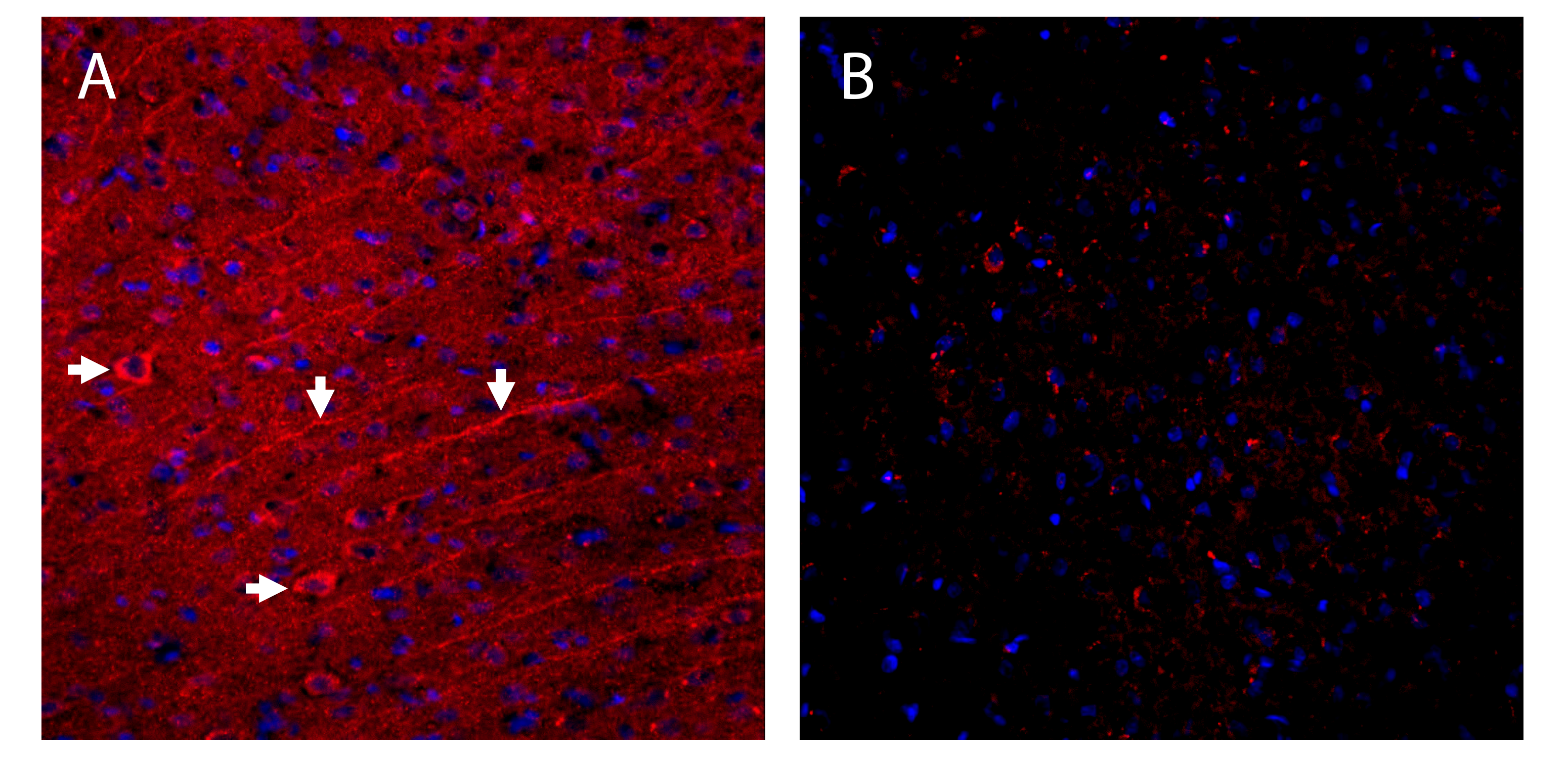 Expression of SynGAP in rat cingulate cortex