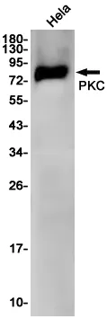 AMRe02450