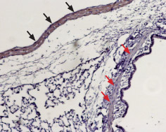 Expression of Sphingosine 1-phosphate receptor 1 in rat lung