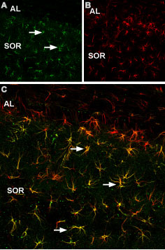 Expression of p75 NTR in mouse hippocampus