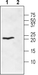 Western blot analysis of rat heart membranes: