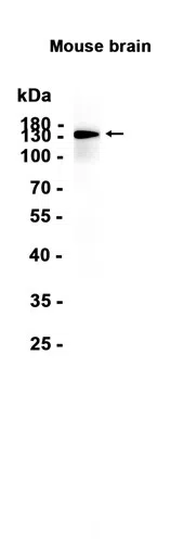 AMRe86325