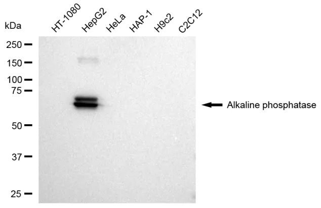KVAb01560