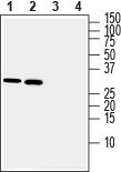 Western blot analysis of rat brain lysate (lanes 1 and 3) and mouse brain lysate (lanes 2 and 4):