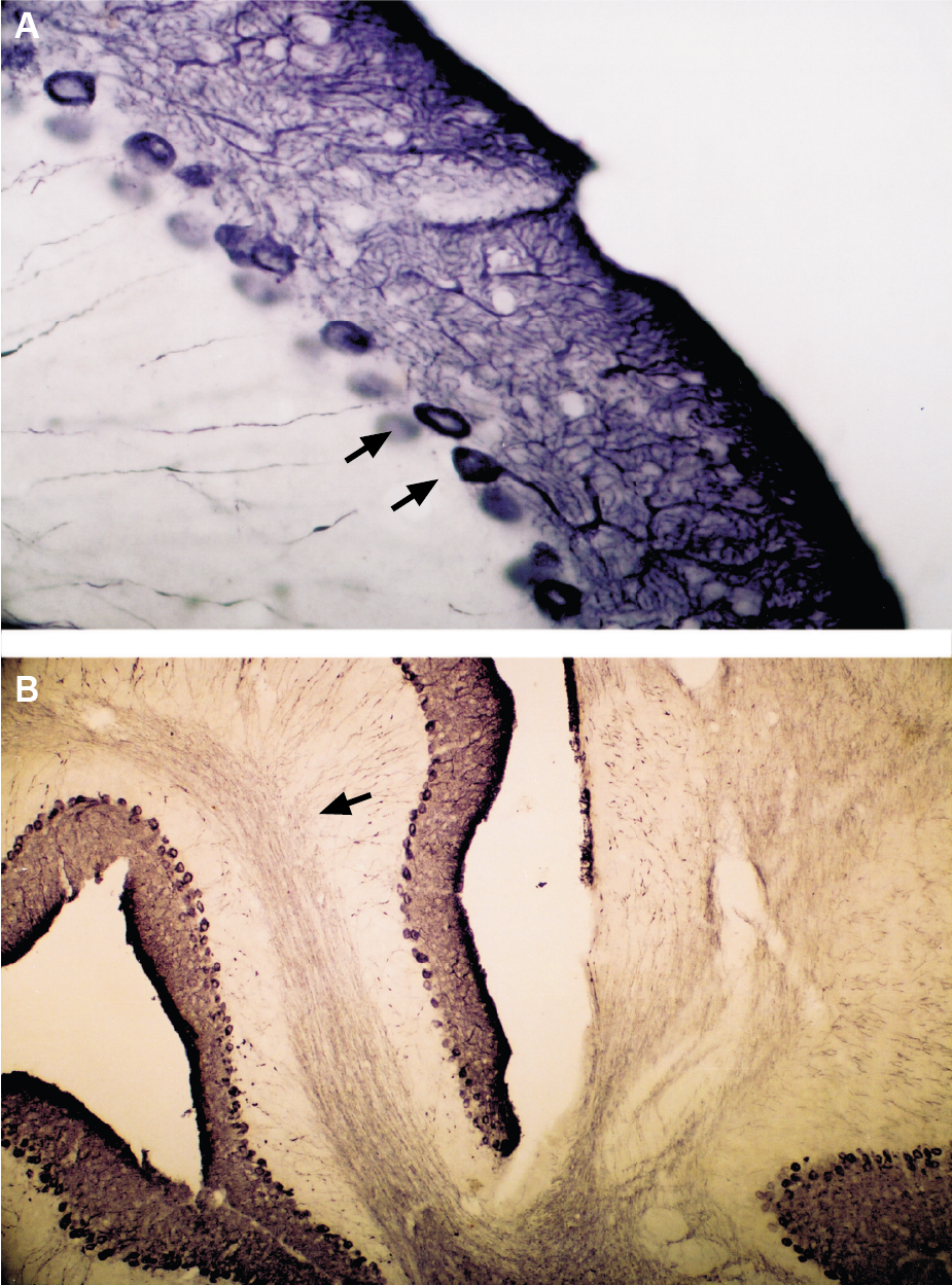 Expression of IP3R1 in mouse cerebellum