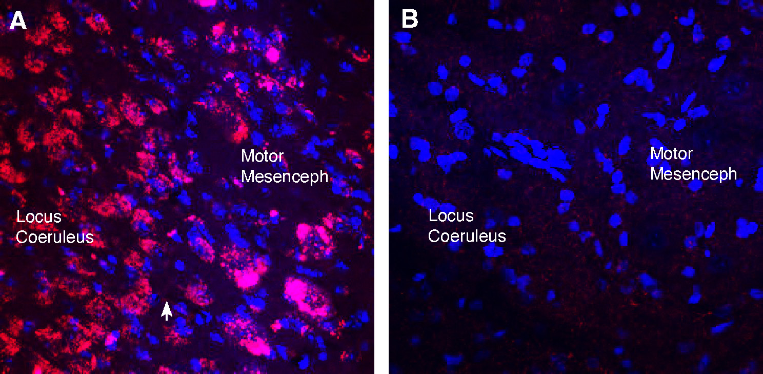 Expression of Cholinergic receptor muscarinic 3 in rat dorsal pons.