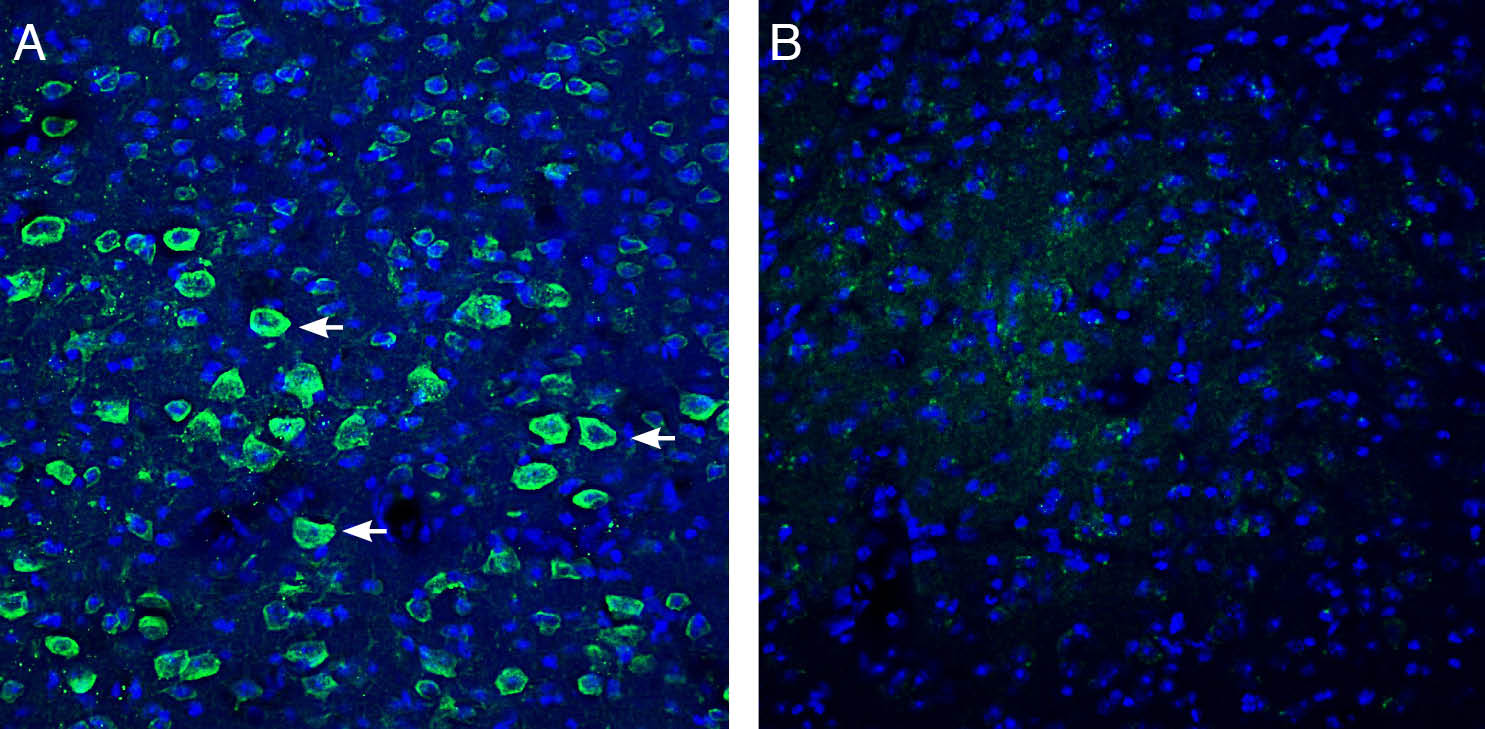 Expression of IGF1 in mouse parietal cortex.
