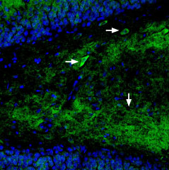 Expression of GluR1 in rat hippocampus