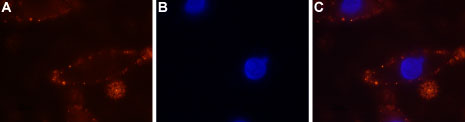 Expression of CaSR in rat C6 cells