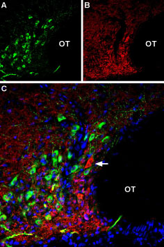 Multiplex staining of AT 2 Receptor and VGLUT2 in rat supraoptic hypothalamic nucleus