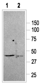 Western blot analysis of rat brain membranes: ​​​​​​​