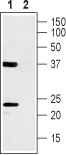 Western blot analysis of rat skeletal muscle lysate: