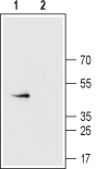 Western blot analysis of rat heart membranes: