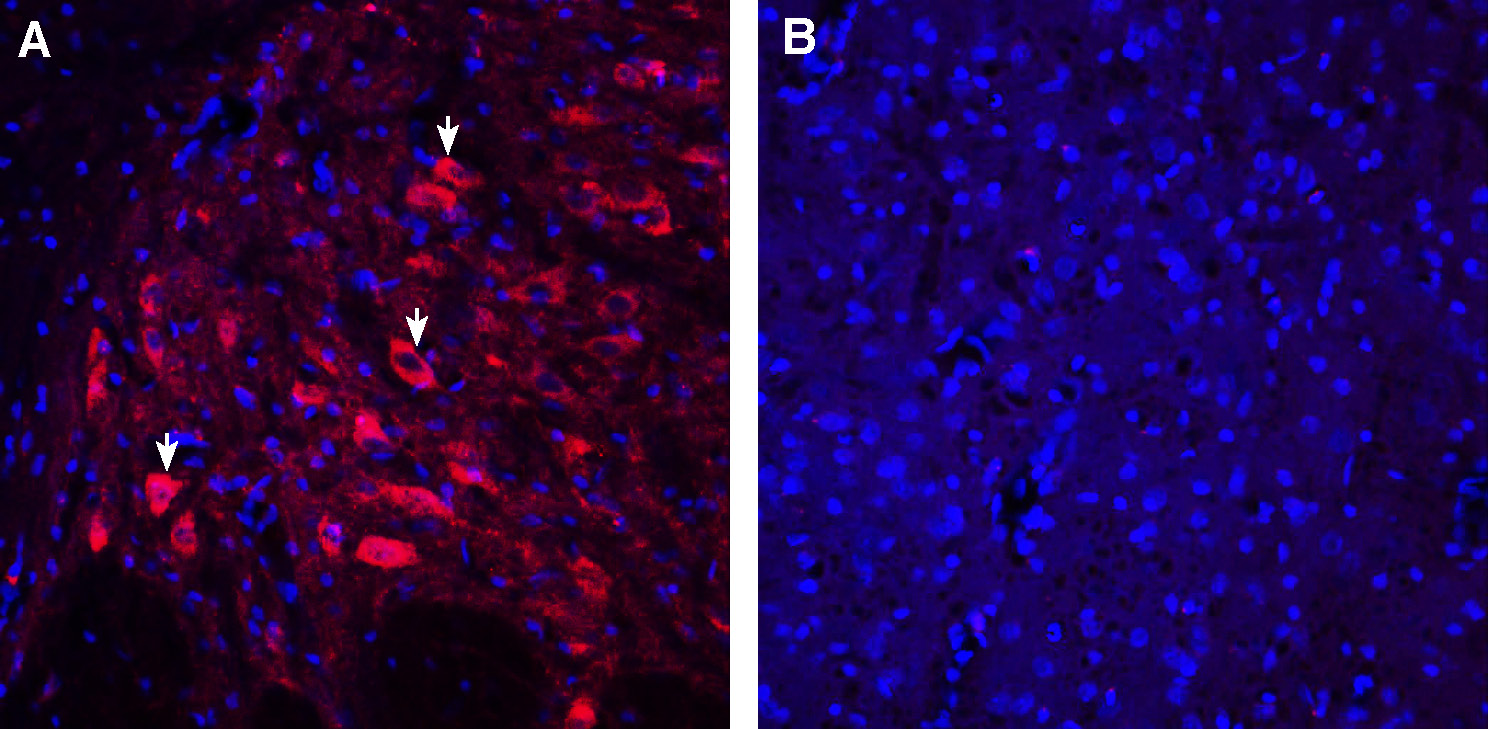 Expression of 5-HT2A in rat dorsal raphe nucleus.