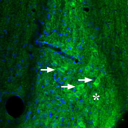 Expression of Adenosine A 2A Receptor in mouse diagonal band