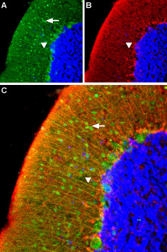 Expression of α 1A -Adrenergic receptor in rat cerebellum