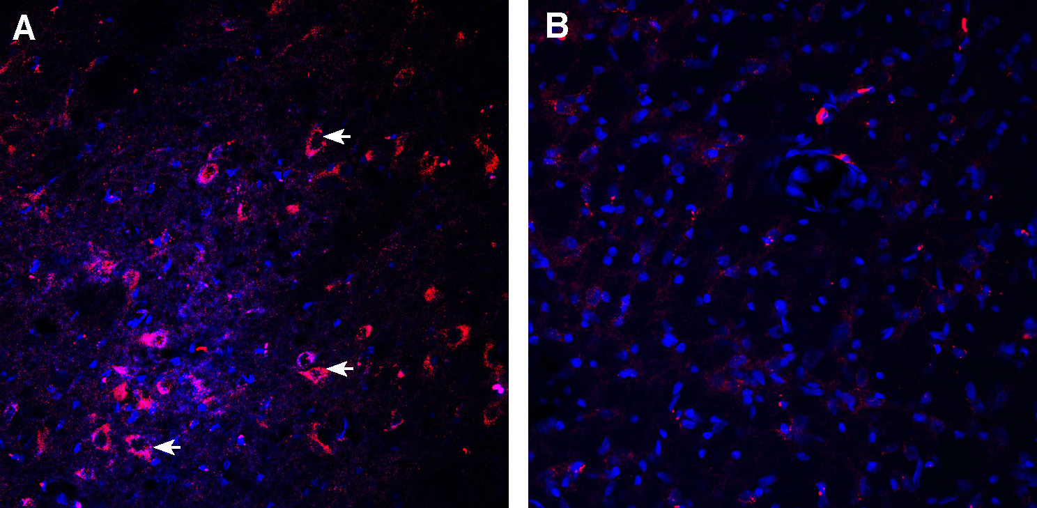 Expression of Dopamine Transporter (DAT) in rat substantia nigra pars compacta.