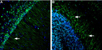 Expression of Presenilin-1 in mouse brain