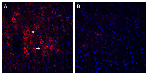 Expression of VGLUT2 in rat parietal cortex.